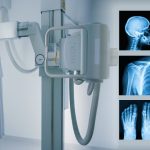 Röntgen Nedir? Geçmişten Günümüze Röntgen Işınlarının Serüveni