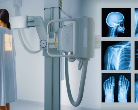 Röntgen Nedir? Geçmişten Günümüze Röntgen Işınlarının Serüveni