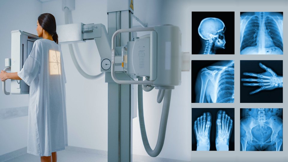 Röntgen Nedir? Geçmişten Günümüze Röntgen Işınlarının Serüveni